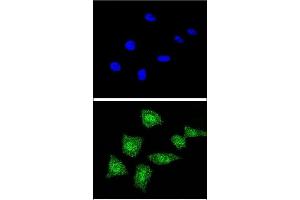 Confocal immunofluorescent analysis of SOD1 Antibody (Center) (ABIN652681 and ABIN2842453) with 293 cell followed by Alexa Fluor® 488-conjugated goat anti-rabbit lgG (green).
