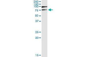 Immunoprecipitation of PIAS2 transfected lysate using anti-PIAS2 MaxPab rabbit polyclonal antibody and Protein A Magnetic Bead , and immunoblotted with PIAS2 purified MaxPab mouse polyclonal antibody (B01P) . (PIAS2 antibody  (AA 1-572))