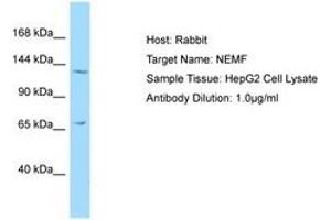 Image no. 1 for anti-serologically Defined Colon Cancer Antigen 1 (SDCCAG1) (C-Term) antibody (ABIN6750217) (NEMF antibody  (C-Term))