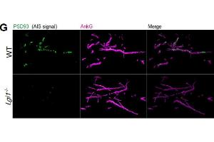 Surface representation of PSD93 labelling at the AIS of CA3 pyramidal neurons in WT (top panels) and Lgi1-/- (bottom panels) mouse hippocampi.