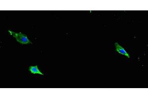Immunofluorescent analysis of Hela cells using ABIN7177325 at dilution of 1:100 and Alexa Fluor 488-congugated AffiniPure Goat Anti-Rabbit IgG(H+L) (ITGB1 antibody  (AA 21-728))