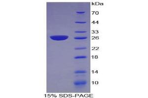 SDS-PAGE (SDS) image for Nicotinamide N-Methyltransferase (NNMT) (AA 1-264) protein (His tag) (ABIN1099346) (NNMT Protein (AA 1-264) (His tag))