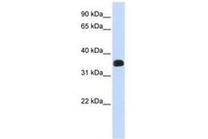 Image no. 1 for anti-Chromosome 2 Open Reading Frame 47 (C2orf47) (C-Term) antibody (ABIN6740965) (C2orf47 antibody  (C-Term))