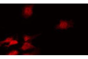 Immunofluorescence (fixed cells) (IF/ICC) image for anti-Cell Division Cycle 25 Homolog A (S. Pombe) (CDC25A) (pSer75) antibody (ABIN6255495)