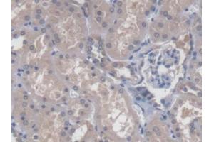 DAB staining on IHC-P; Samples: Human Kidney Tissue (CBY1/PGEA1 antibody  (AA 12-115))
