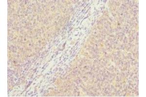 Immunohistochemistry of paraffin-embedded human tonsil tissue using ABIN7162885 at dilution of 1:100 (PCM1 antibody  (AA 1-260))