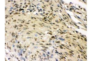 Immunohistochemistry (IHC) image for anti-ELAV (Embryonic Lethal, Abnormal Vision, Drosophila)-Like 4 (Hu Antigen D) (ELAVL4) (AA 8-45), (N-Term) antibody (ABIN3043372)