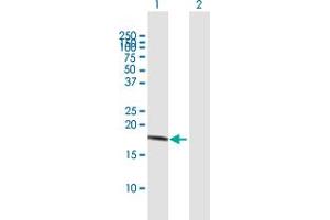 Western Blot analysis of IL10 expression in transfected 293T cell line by IL10 MaxPab polyclonal antibody. (IL-10 antibody  (AA 1-178))