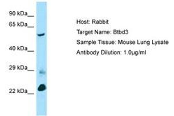 BTBD3 antibody  (AA 367-416)