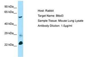 Image no. 1 for anti-BTB (POZ) Domain Containing 3 (BTBD3) (AA 367-416) antibody (ABIN6749832) (BTBD3 antibody  (AA 367-416))