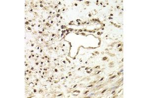 Immunohistochemistry of paraffin-embedded human leiomyoma of uterus using FKBP4 Antibody (ABIN5973289) at dilution of 1/200 (40x lens). (FKBP4 antibody)