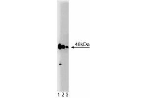 Western blot analysis of Caspase-2 on Jurkat cell lysate. (Caspase 2 antibody  (AA 225-401))