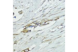 Immunohistochemistry (IHC) image for anti-Suppressor of Cytokine Signaling 5 (SOCS5) (AA 1-140) antibody (ABIN6148271)
