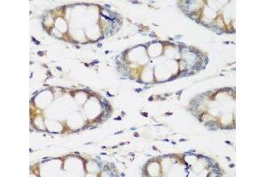 Immunohistochemistry of paraffin-embedded Human colon using BMP2 Polyclonal Antibody at dilution of 1:200 (40x lens). (BMP2 antibody)