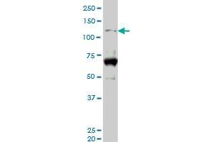 HIPK2 monoclonal antibody (M06), clone 4E3.