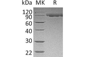 Western Blotting (WB) image for Serpin Peptidase Inhibitor, Clade G (C1 Inhibitor), Member 1 (SERPING1) protein (His tag) (ABIN7320645) (SERPING1 Protein (His tag))