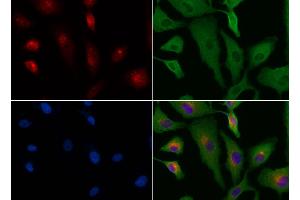 ABIN6264533 and ABIN6276573 staining HUVEC cells by IF/ICC. (PYCARD antibody  (N-Term))