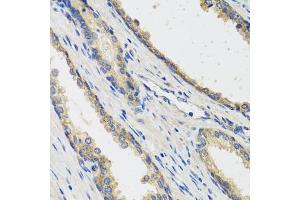 Immunohistochemistry of paraffin-embedded human prostate using RAD51C antibody (ABIN5974185) at dilution of 1/100 (40x lens).