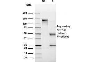 SDS-PAGE Analysis Purified HLA-Pan Mouse Monoclonal Antibody (CR3/43). (MHC Class II HLA-DP/DQ/DR antibody)