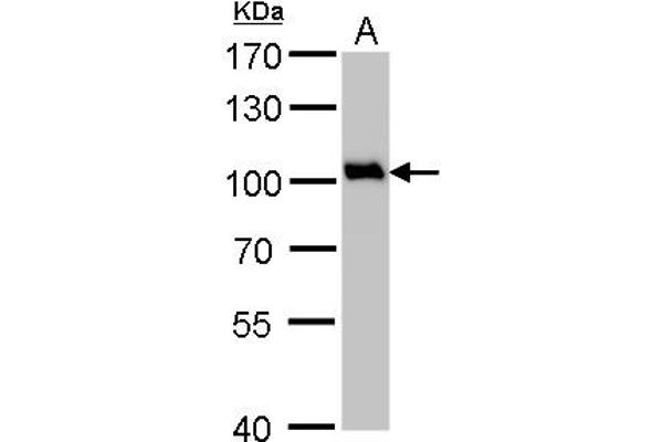 VCP anticorps  (N-Term)