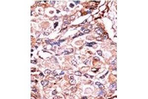 Image no. 2 for anti-SMAD, Mothers Against DPP Homolog 3 (SMAD3) (pSer213) antibody (ABIN358226) (SMAD3 antibody  (pSer213))