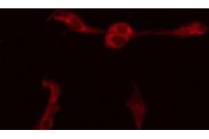 ABIN6277217 staining HepG2 by IF/ICC. (BIK antibody  (N-Term))
