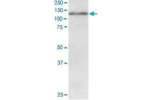 USP11 polyclonal antibody  staining (1 ug/mL) of Jurkat lysate (RIPA buffer, 30 ug total protein per lane). (USP11 antibody)