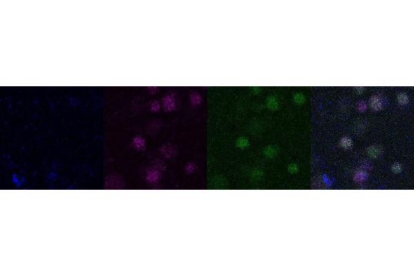 SATB2 antibody