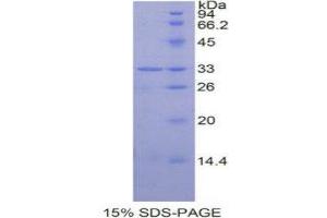 SDS-PAGE (SDS) image for Signal Transducer and Activator of Transcription 6, Interleukin-4 Induced (STAT6) (AA 262-520) protein (His tag) (ABIN1877493) (STAT6 Protein (AA 262-520) (His tag))