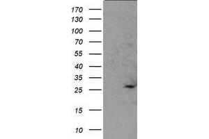 Western Blotting (WB) image for anti-Suppressor of Cytokine Signaling 3 (SOCS3) antibody (ABIN1501060) (SOCS3 antibody)