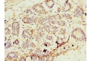 Immunohistochemistry of paraffin-embedded human breast cancer using ABIN7164746 at dilution of 1:100 (PA2G4 antibody  (AA 2-394))