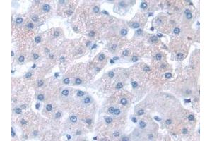 GNB1L antibody  (AA 69-247)