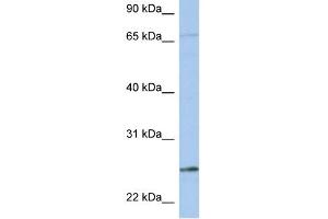 WB Suggested Anti-KLK6 Antibody Titration:  0. (Kallikrein 6 antibody  (N-Term))