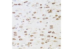 Immunohistochemistry of paraffin-embedded rat brain using ARHGAP5 antibody (ABIN1871080) at dilution of 1:100 (40x lens). (ARHGAP5 antibody)