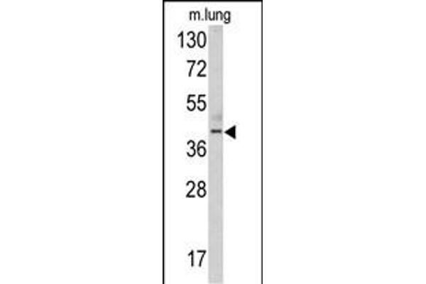 TDG anticorps  (N-Term)