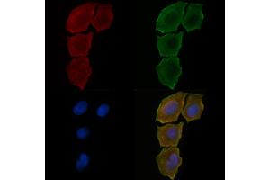 ABIN6258471 and ABIN6275673 staining Hela cells(30 min of UV treatment) by IF/ICC. (VTI1A antibody  (Internal Region))