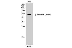 Western Blotting (WB) image for anti-Heterogeneous Nuclear Ribonucleoprotein K (HNRNPK) (pSer284) antibody (ABIN3179548) (HNRNPK antibody  (pSer284))