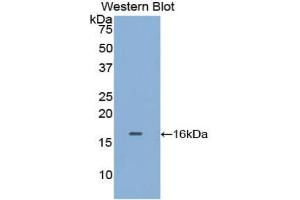 Western blot analysis of the recombinant protein. (TPSAB1 antibody  (AA 29-148))
