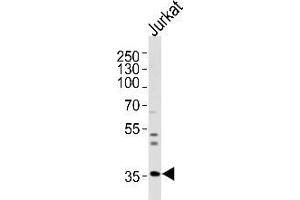 Western blot analysis of lysate from Jurkat cell line, using Glycine receptor beta Antibody (N-term) Cat.