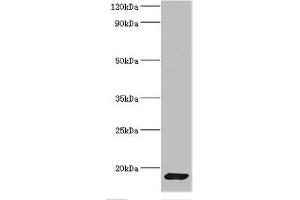 Western blot All lanes: CALM1 antibody at 2 μg/mL + Mouse skeletal muscle tissue Secondary Goat polyclonal to rabbit IgG at 1/10000 dilution Predicted band size: 17 kDa Observed band size: 17 kDa (Calmodulin 1 antibody  (AA 2-149))