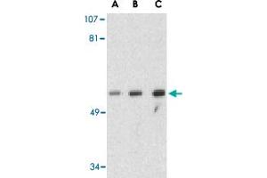 Western blot analysis of GOPC in PC-3 cell lysate with GOPC polyclonal antibody  at (A) 1, (B) 2 and (C) 4 ug/mL .