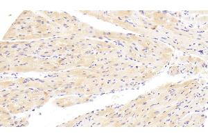 Immunohistochemistry (IHC) image for anti-WNT1 Inducible Signaling Pathway Protein 1 (WISP1) (AA 213-350) antibody (ABIN7436372)