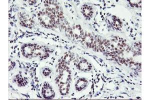 Immunohistochemical staining of paraffin-embedded Human breast tissue using anti-RNF113B mouse monoclonal antibody. (RNF113B antibody)