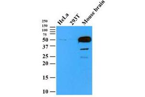 Western Blotting (WB) image for anti-Tubulin, beta 2B (TUBB2B) antibody (ABIN567612) (TUBB2B antibody)