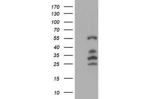 Western Blotting (WB) image for anti-Interferon Regulatory Factor 6 (IRF6) antibody (ABIN1498901)