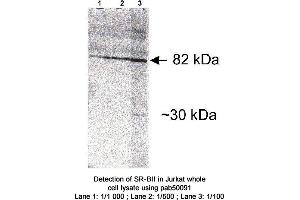 Image no. 1 for anti-Scavenger Receptor Class B, Member 2 (SCARB2) antibody (ABIN363400) (SCARB2 antibody)