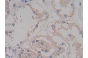 Immunohistochemistry (IHC) image for anti-Syndecan 1 (SDC1) (AA 23-253) antibody (ABIN7434419)