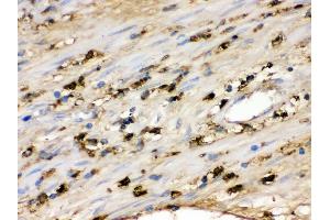 IHC(P): Human Appendicitis Tissue (S100A9 antibody  (AA 2-114))