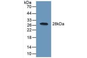 UCHL1 antibody  (AA 2-223)