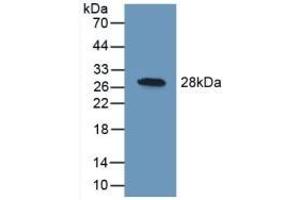 Detection of Recombinant UCHL1, Human using Polyclonal Antibody to Ubiquitin Carboxyl Terminal Hydrolase L1 (UCHL1) (UCHL1 antibody  (AA 2-223))